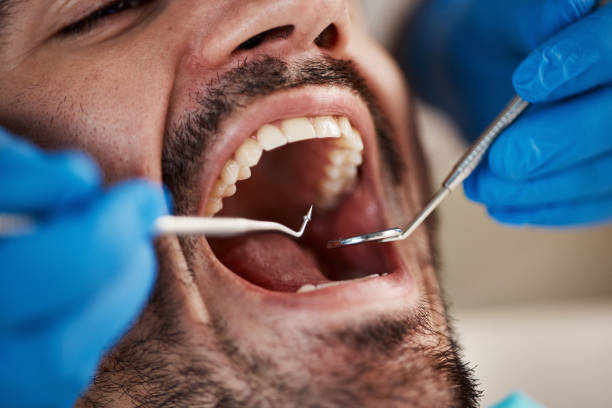 Best Emergency Dental Care for Sports Injuries in Sandia Knolls, NM