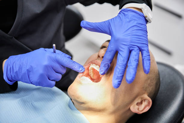 Best Broken or Chipped Tooth Repair in Sandia Knolls, NM